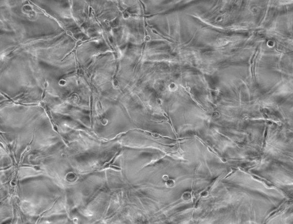 Fibroblasts